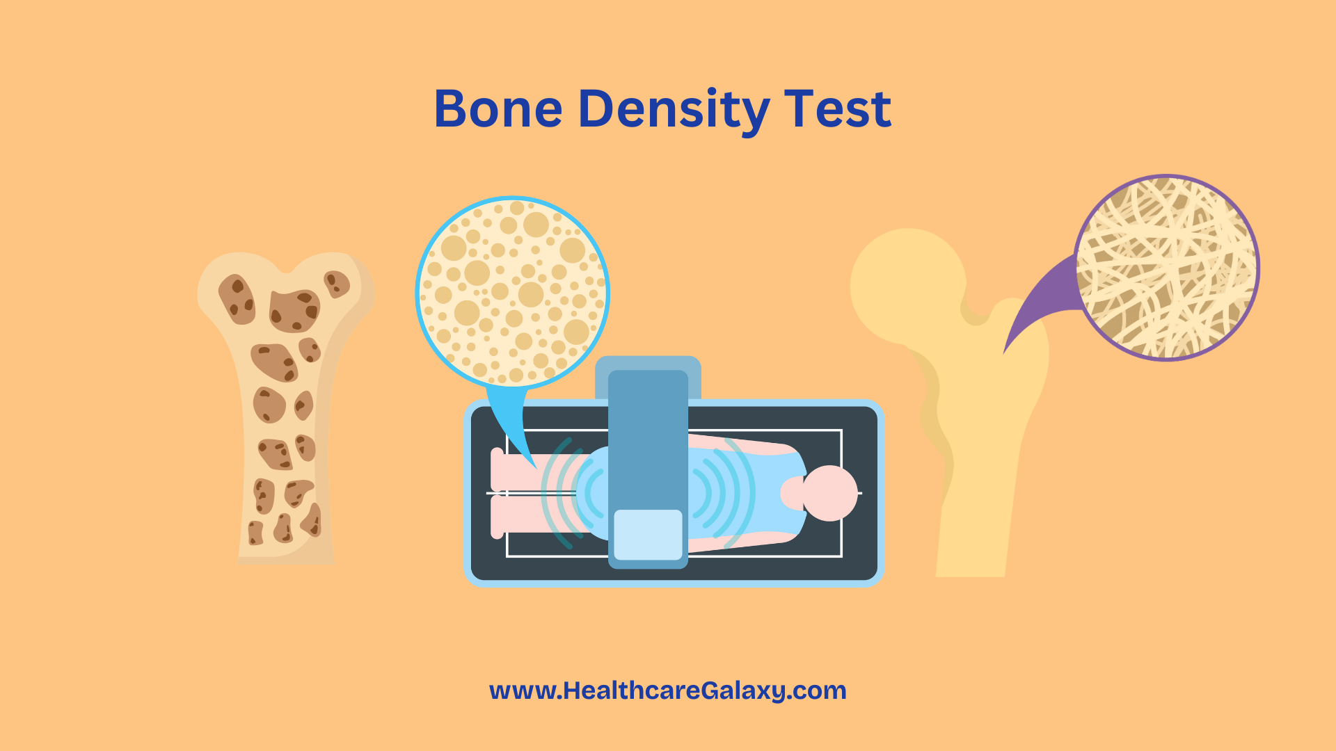 Stop Bone Loss Now: Surprising Truth About Bone Density Tests